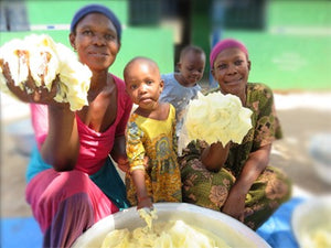 Why Shea Butter Champions Age spots